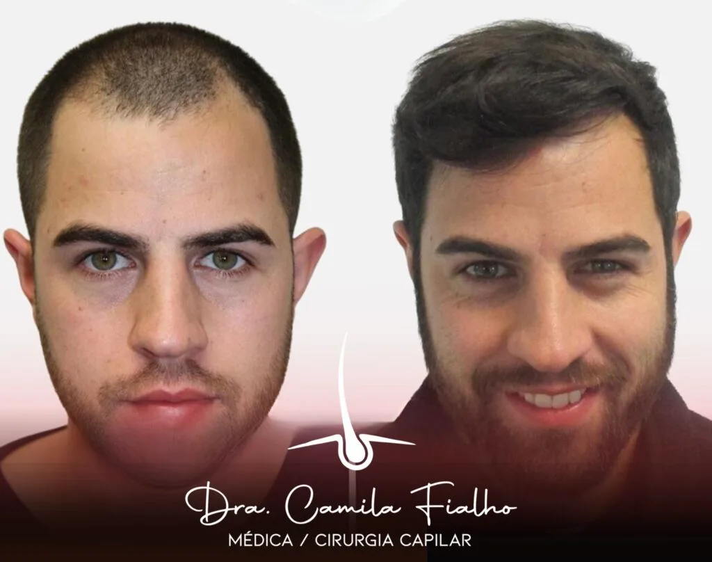 Antes e depois 07